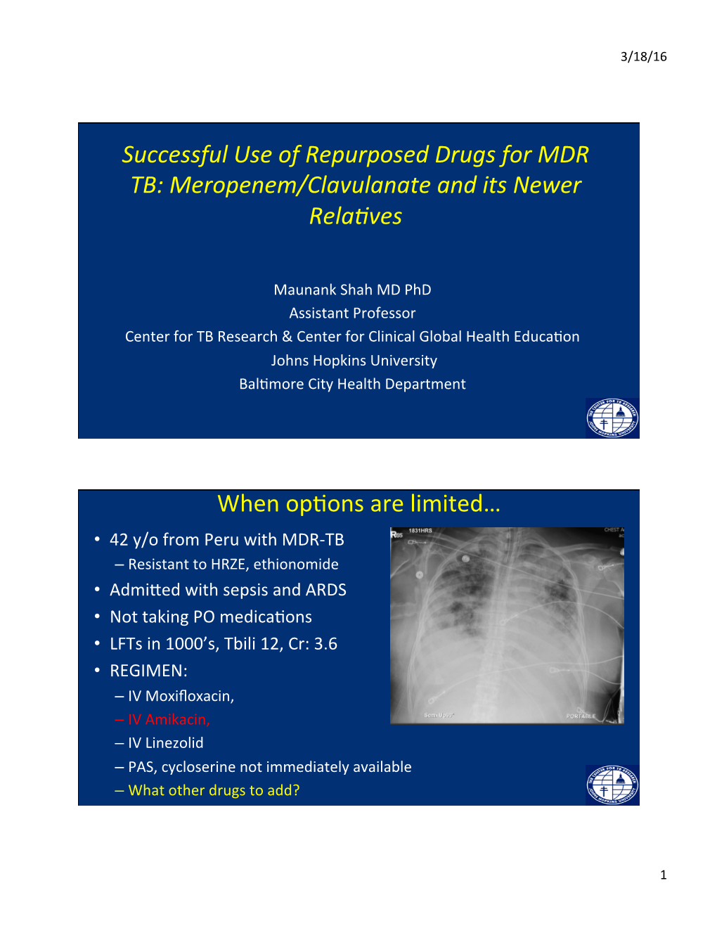 Successful Use of Repurposed Drugs for MDR TB: Meropenem/Clavulanate and Its Newer Rela�Ves