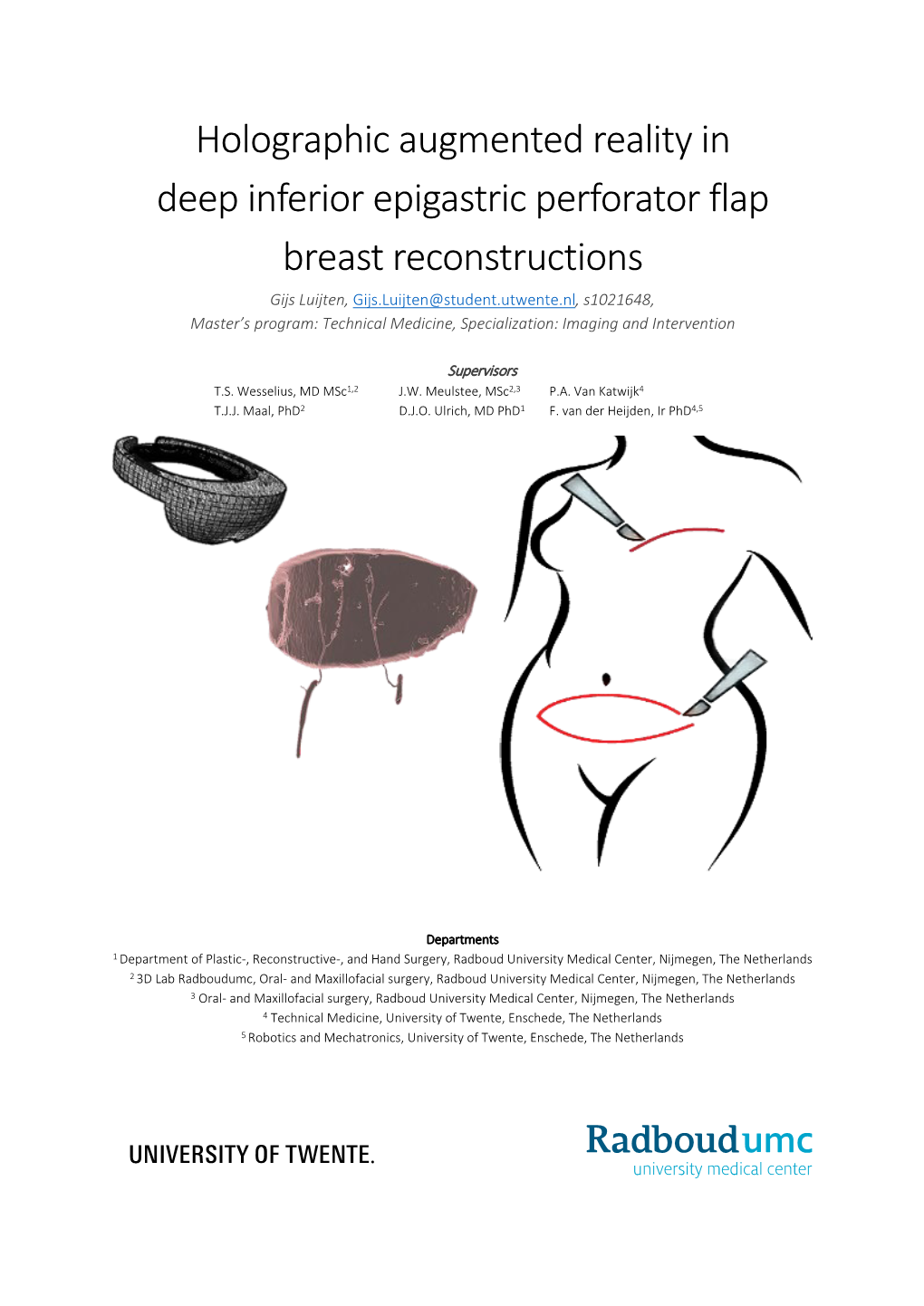 Holographic Augmented Reality in Deep Inferior Epigastric Perforator Flap