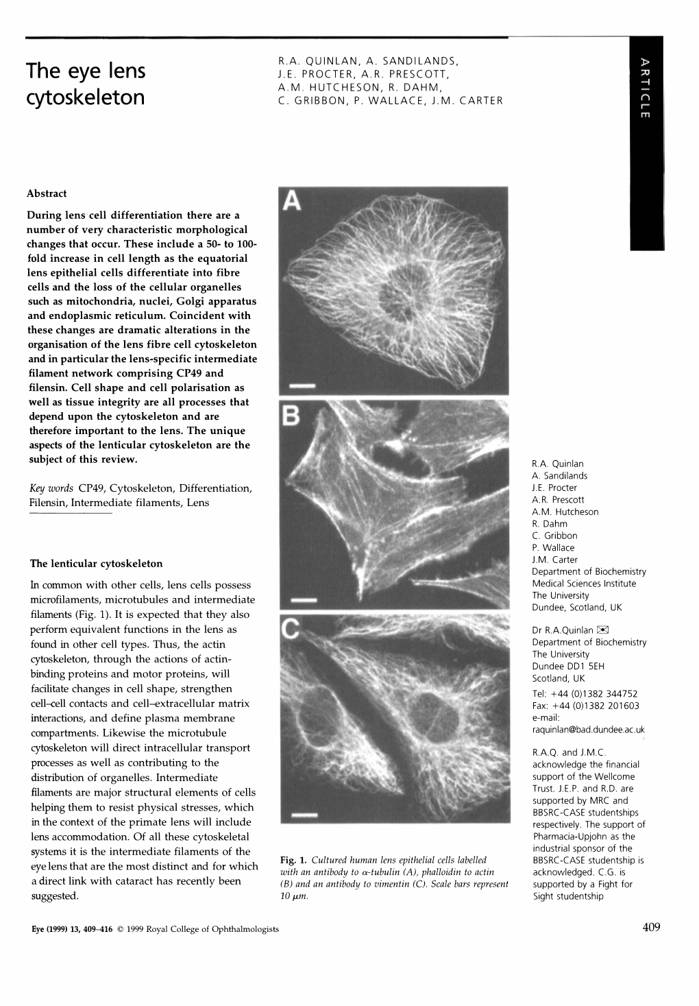 The Eye Lens Cytoskeleton