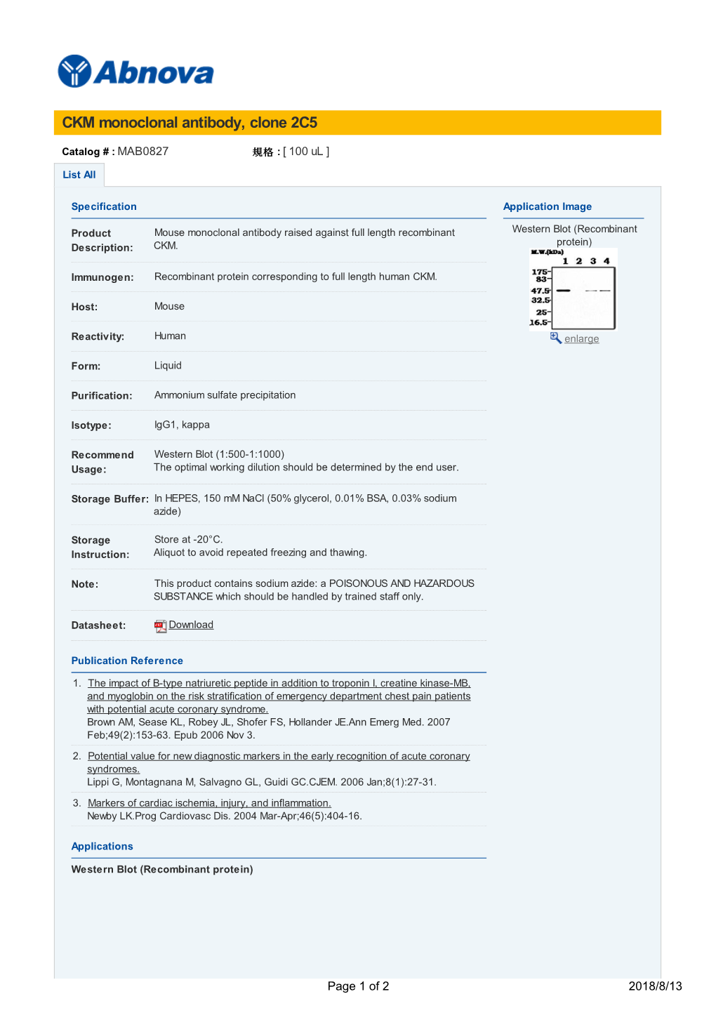 CKM Monoclonal Antibody, Clone 2C5