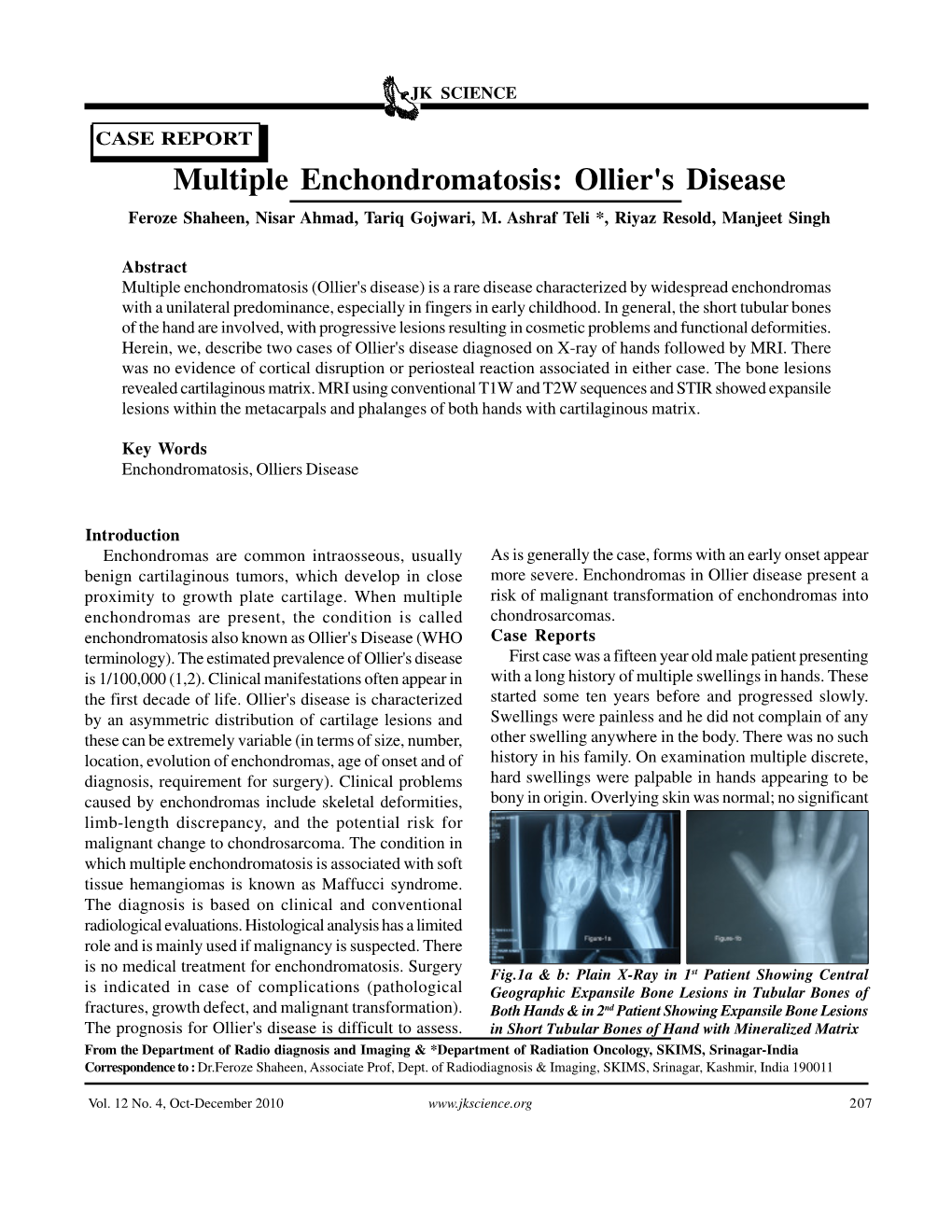 Ollier's Disease Feroze Shaheen, Nisar Ahmad, Tariq Gojwari, M