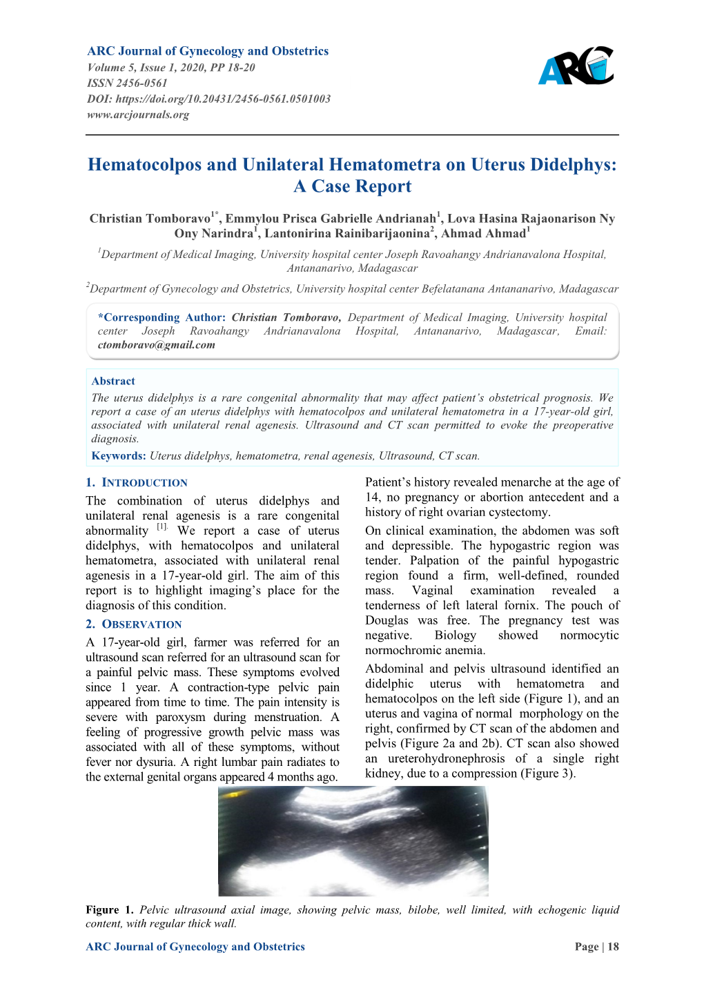 Hematocolpos and Unilateral Hematometra on Uterus Didelphys: a Case Report