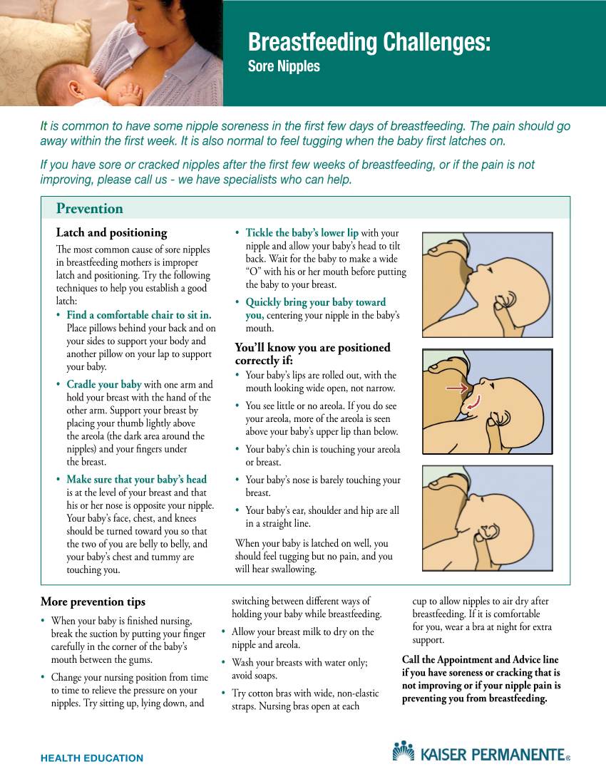 Breastfeeding Challenges: Sore Nipples