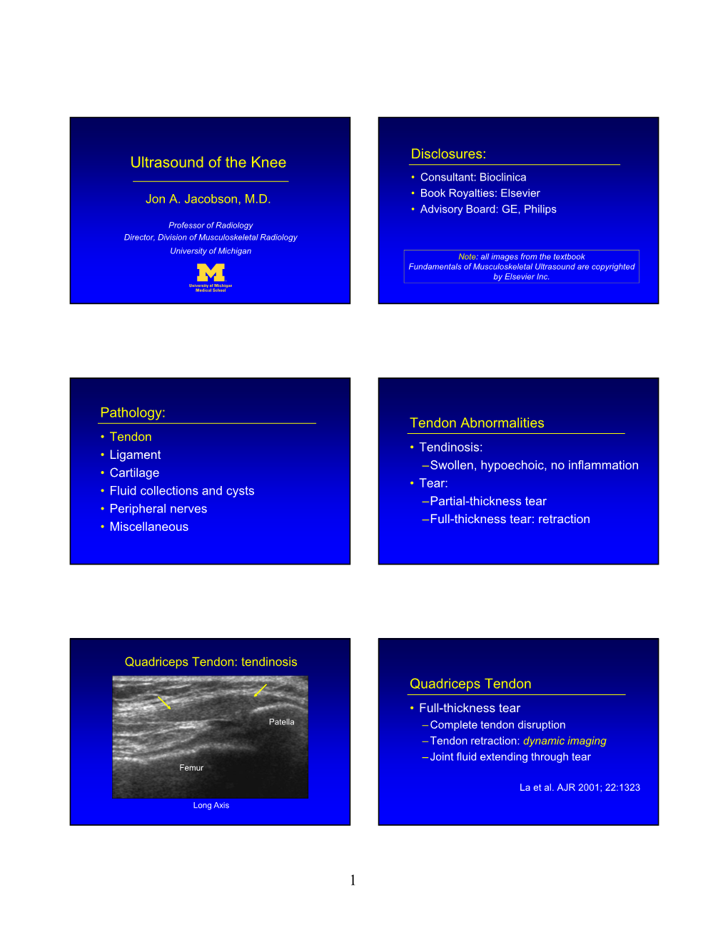 1 Ultrasound of the Knee