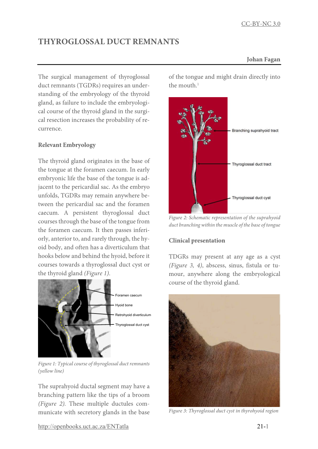 Thyroglossal Duct Remnants