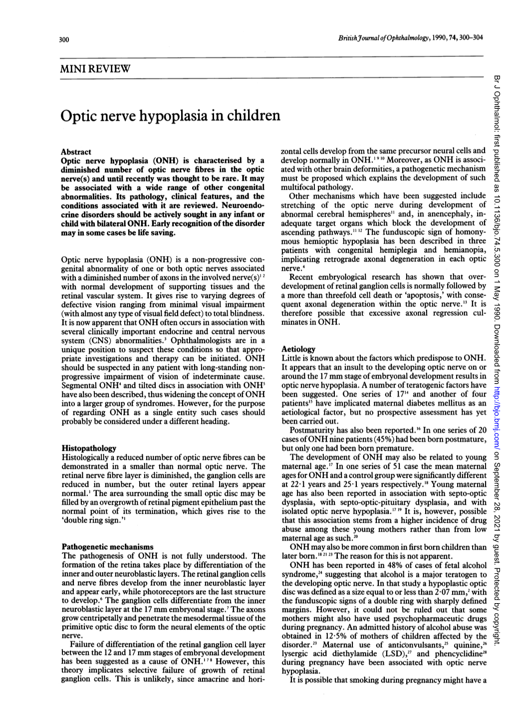 Optic Nerve Hypoplasia in Children