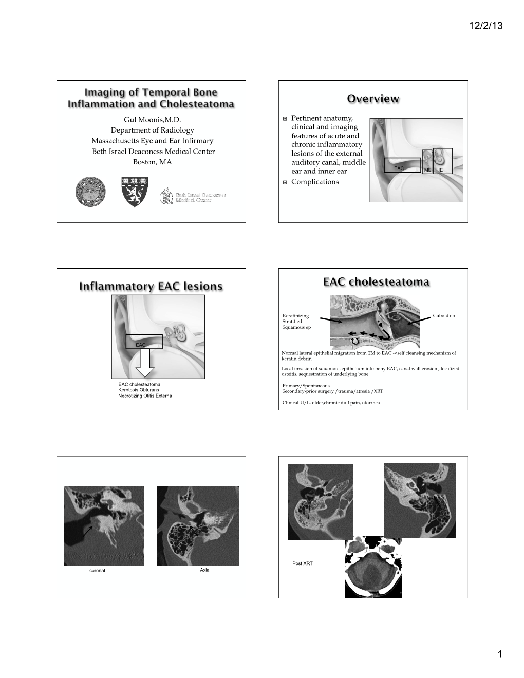 Cholesteatoma RSNA 2013.Pptx
