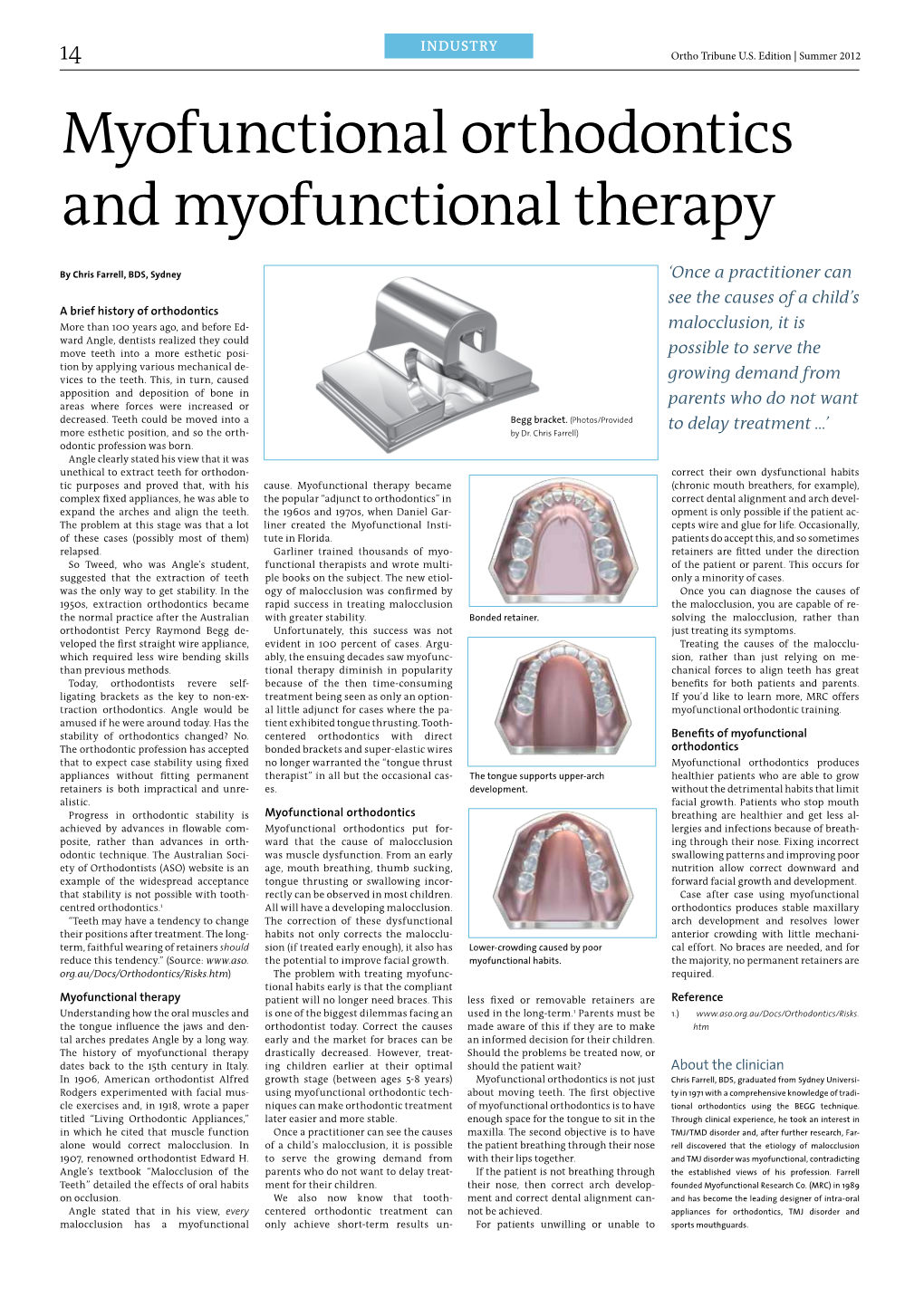 Myofunctional Orthodontics and Myofunctional Therapy