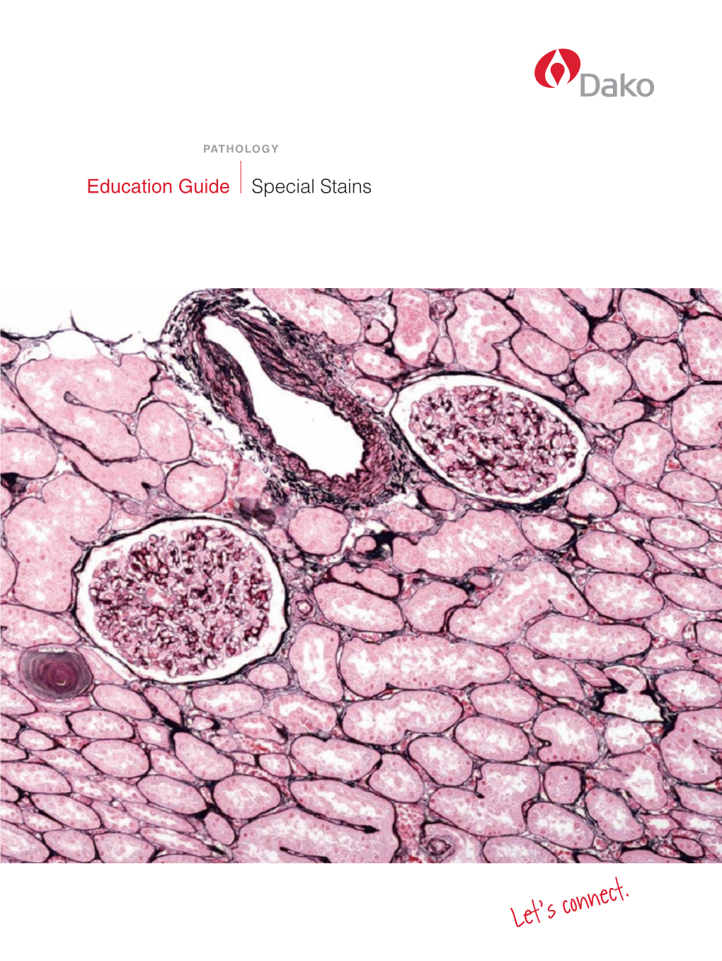 Education Guide Special Stains Dako Provides Cancer Diagnostic Products for Leading Reference Laboratories, Hospitals and Other Clinical and Research Settings