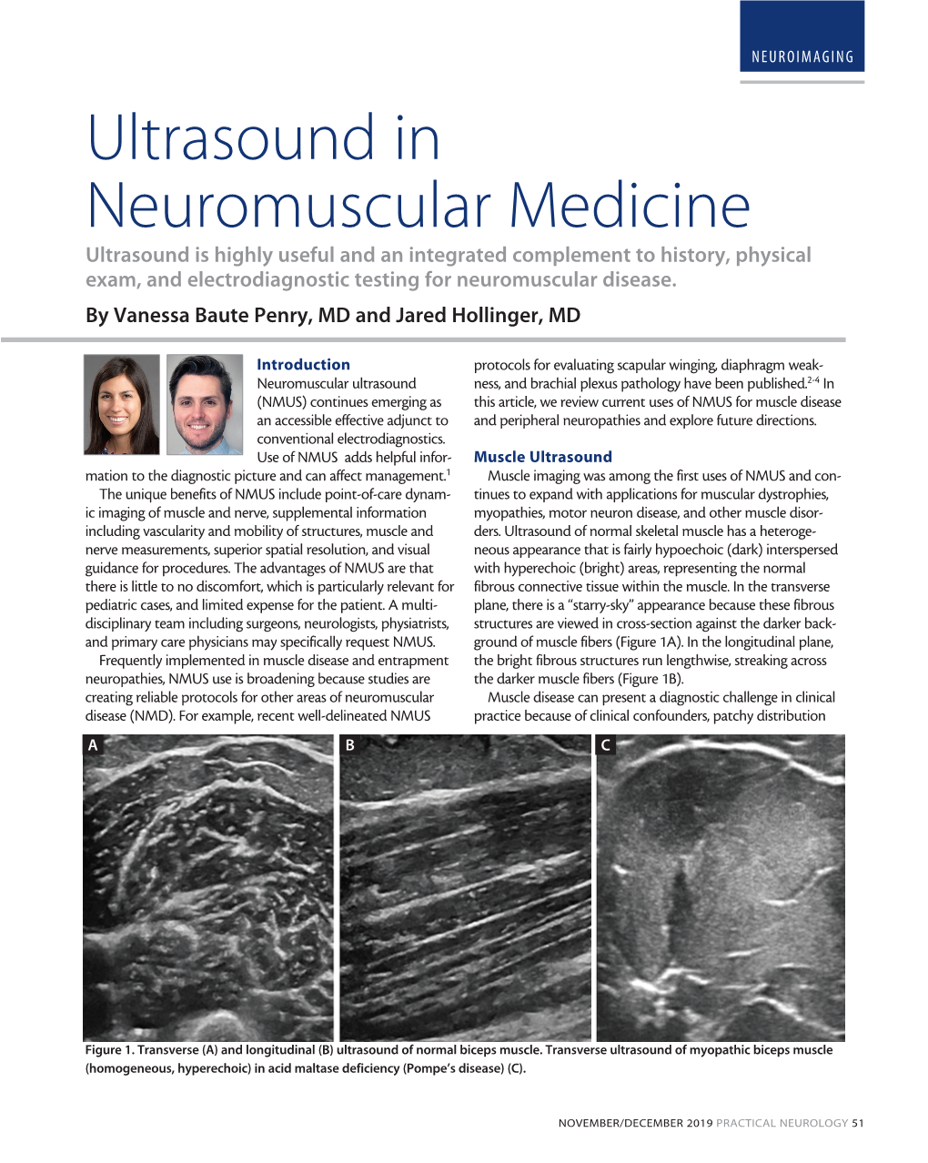 Ultrasound in Neuromuscular Medicine
