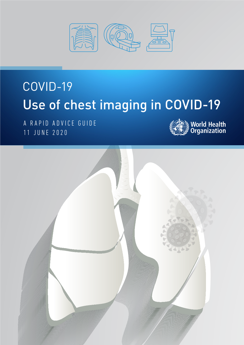 Use of Chest Imaging in COVID-19 a RAPID ADVICE GUIDE 11 JUNE 2020