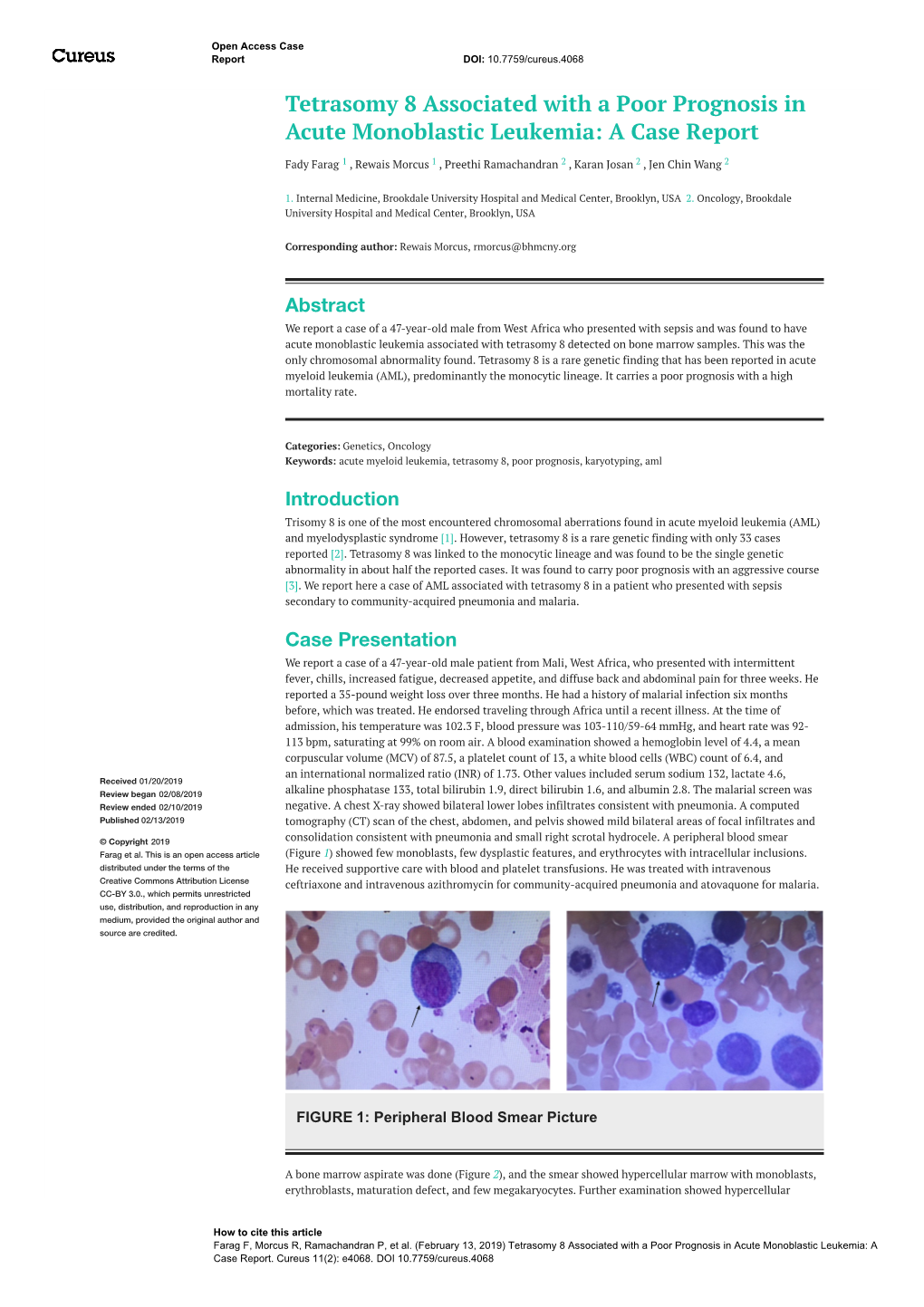 Tetrasomy 8 Associated with a Poor Prognosis in Acute Monoblastic Leukemia: a Case Report