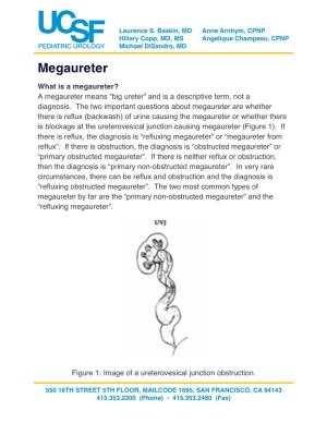 Megaureter 080615.Pdf