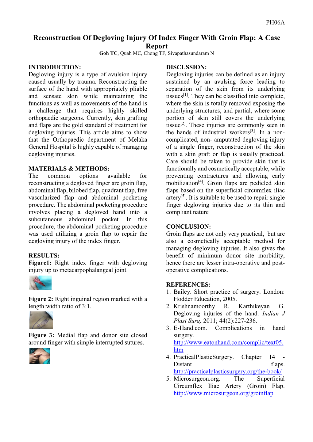 Reconstruction of Degloving Injury of Index Finger with Groin Flap: a Case Report Goh TC, Quah MC, Chong TF, Sivapathasundaram N