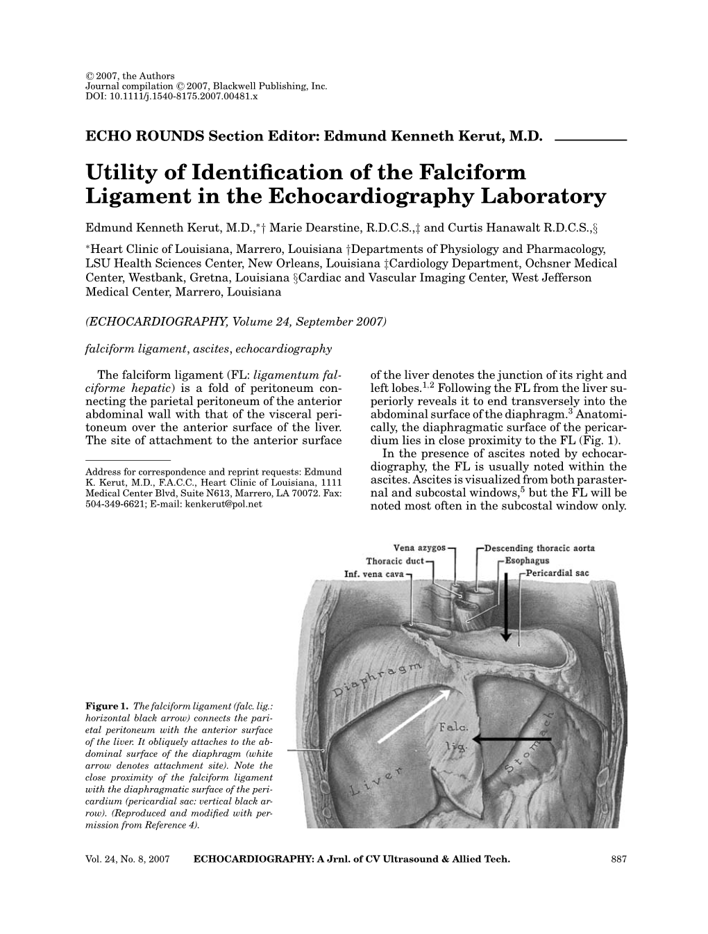 Utility of Identification of the Falciform Ligament in the Echocardiography