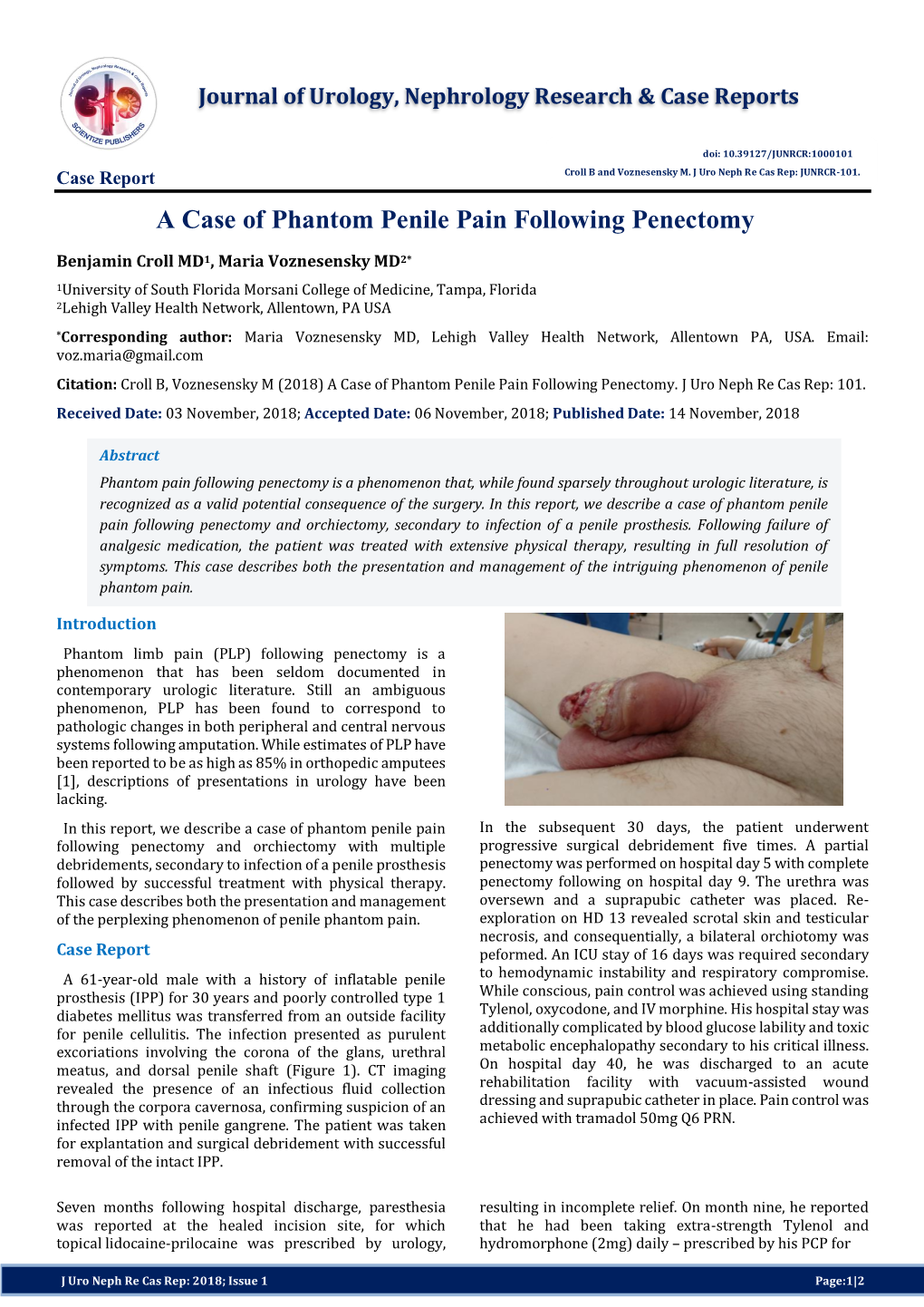 A Case of Phantom Penile Pain Following Penectomy