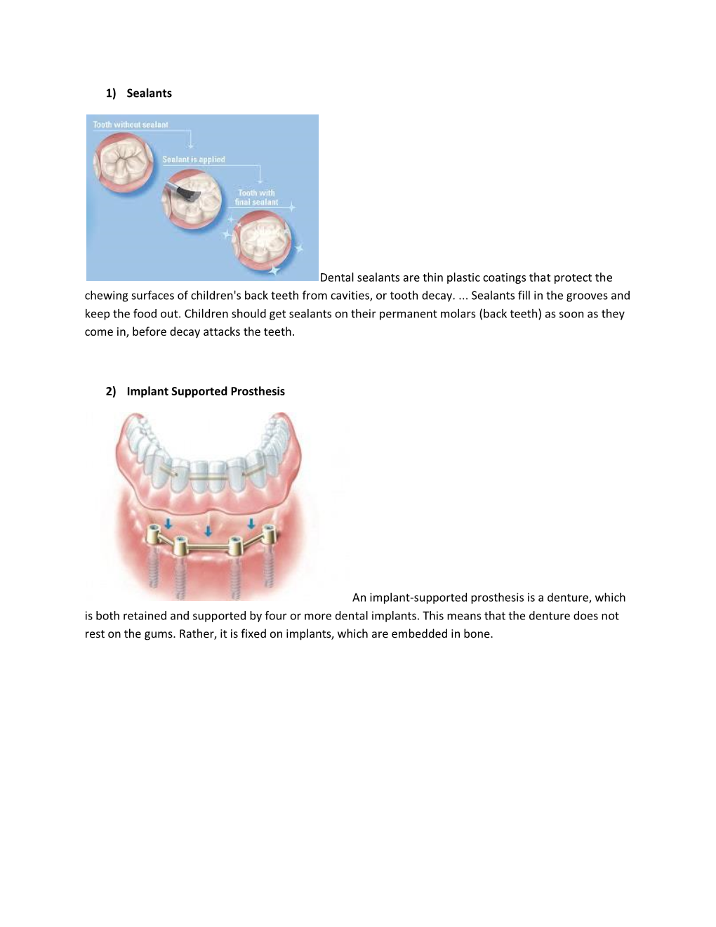 1) Sealants Dental Sealants Are Thin