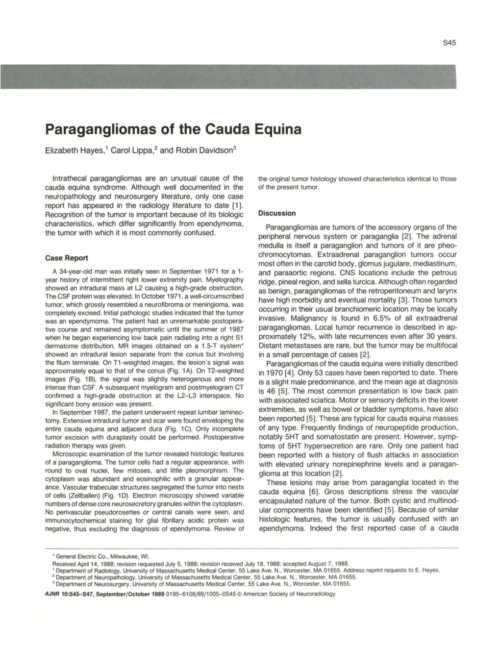 Paragangliomas of the Cauda Equina