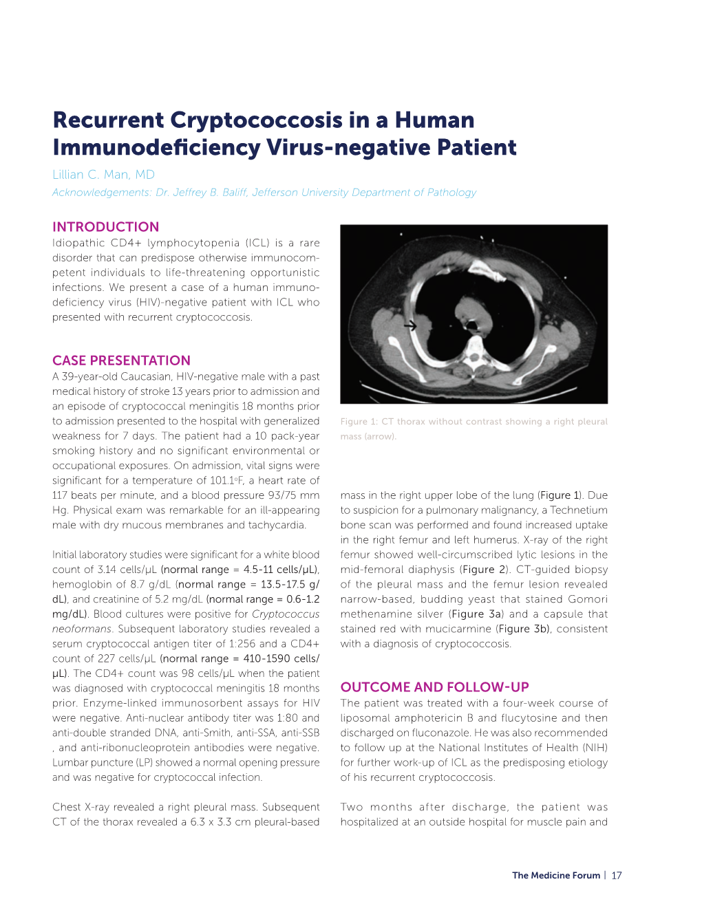 Recurrent Cryptococcosis in a Human Immunodeficiency Virus-Negative Patient Lillian C
