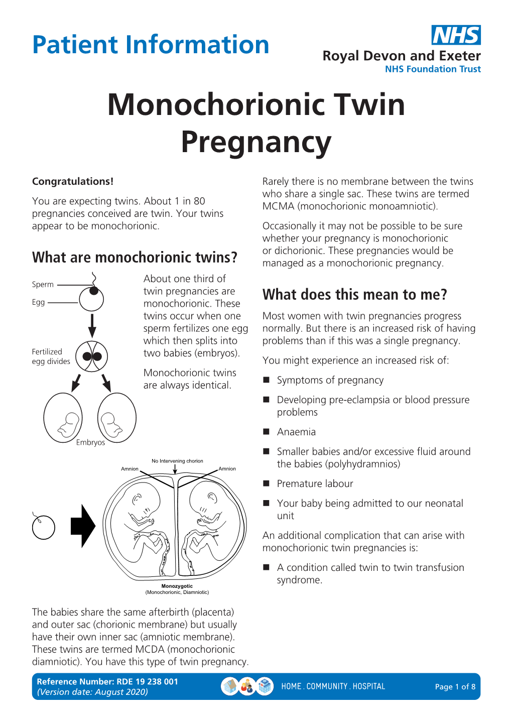 Monochorionic Twin Pregnancy