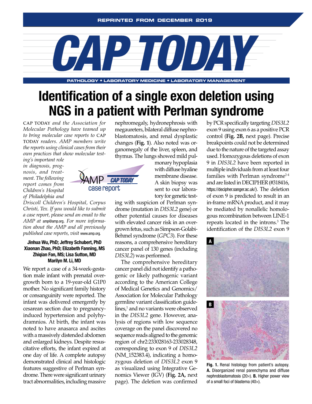 Identification of a Single Exon Deletion Using NGS in a Patient with Perlman Syndrome