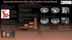 Jejunoileal Diverticulitis: Big Trouble in Small Bowel