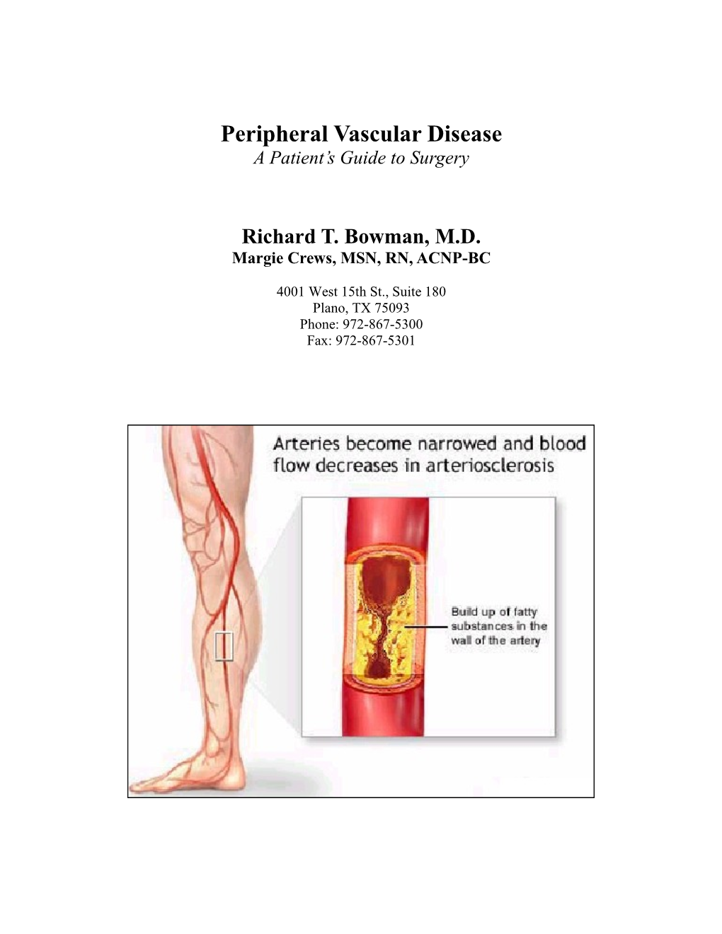 Peripheral Vascular Disease a Patient’S Guide to Surgery