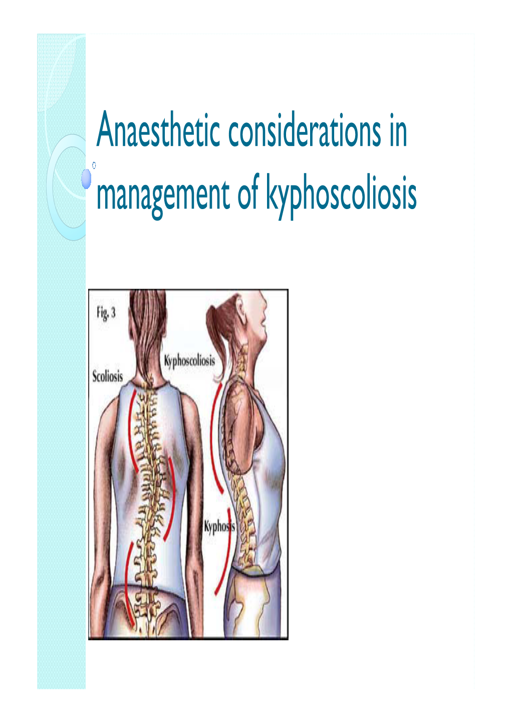 Anaesthetic Considerations in Management of Kyphoscoliosis