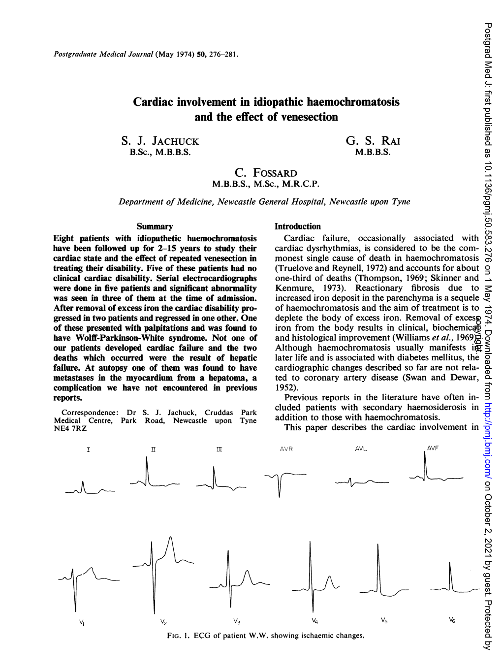 Cardiac Involvement in Idiopathic Haemochromatosis and the Effect of Venesection S. J. JACHUCK G. S. RAI M