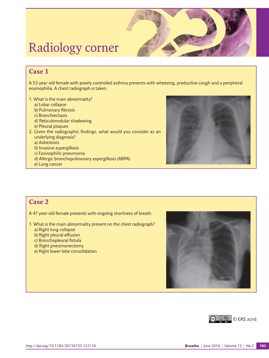 Radiology Corner