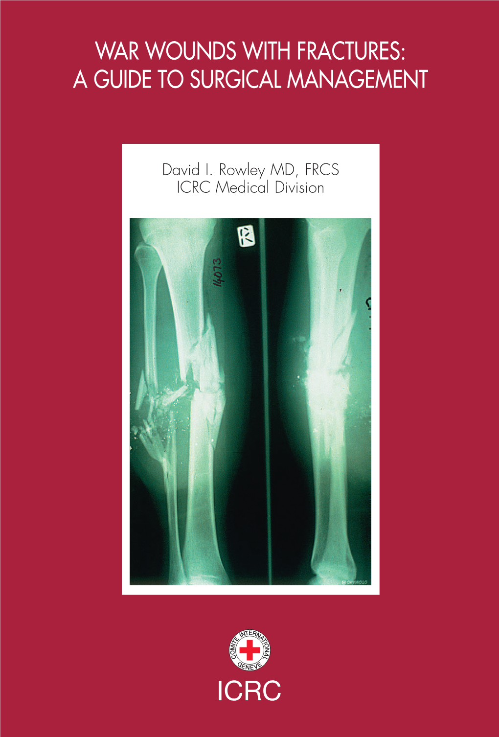 War Wounds with Fractures: a Guide to Surgical Management