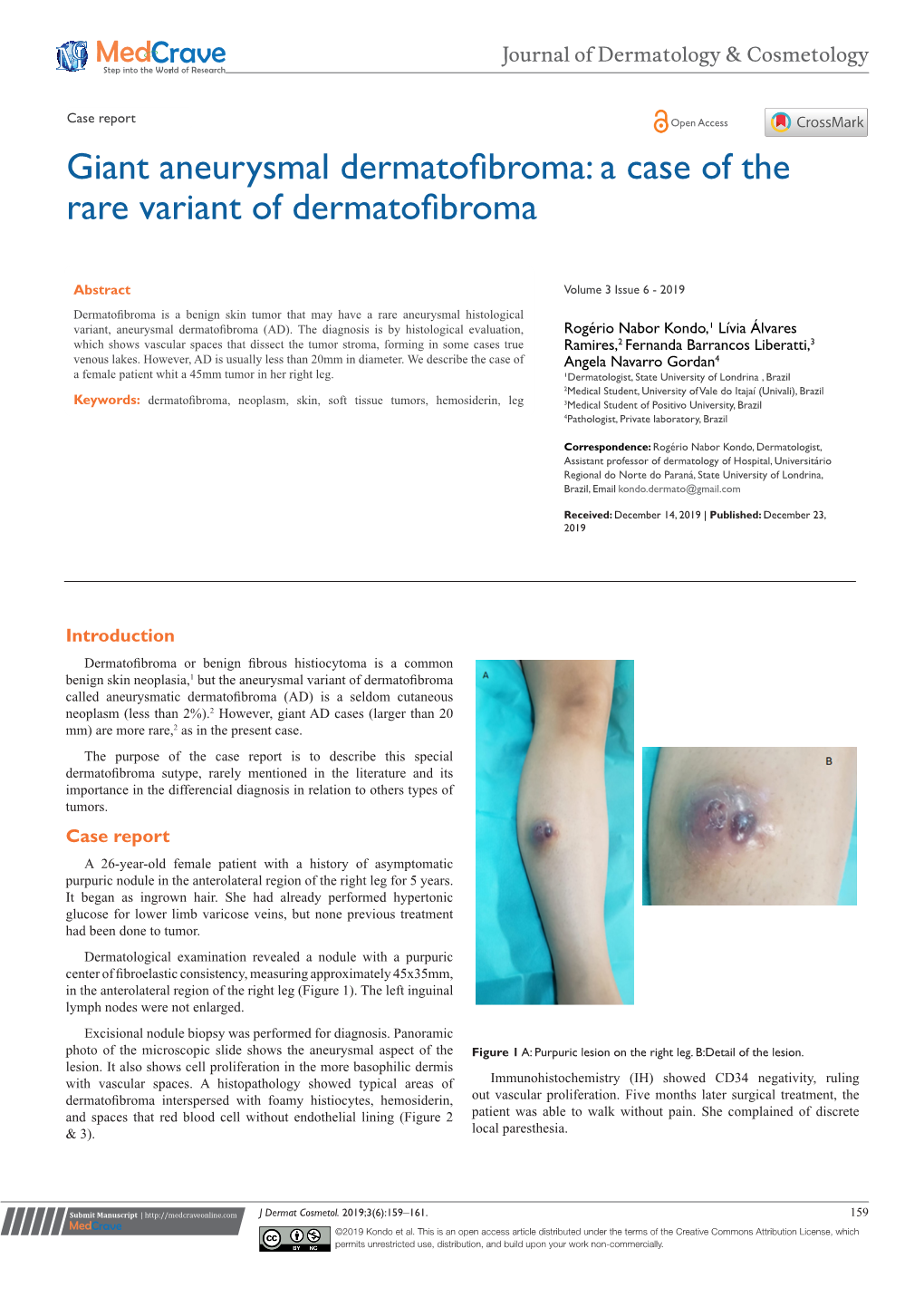 Giant Aneurysmal Dermatofibroma: a Case of the Rare Variant of Dermatofibroma