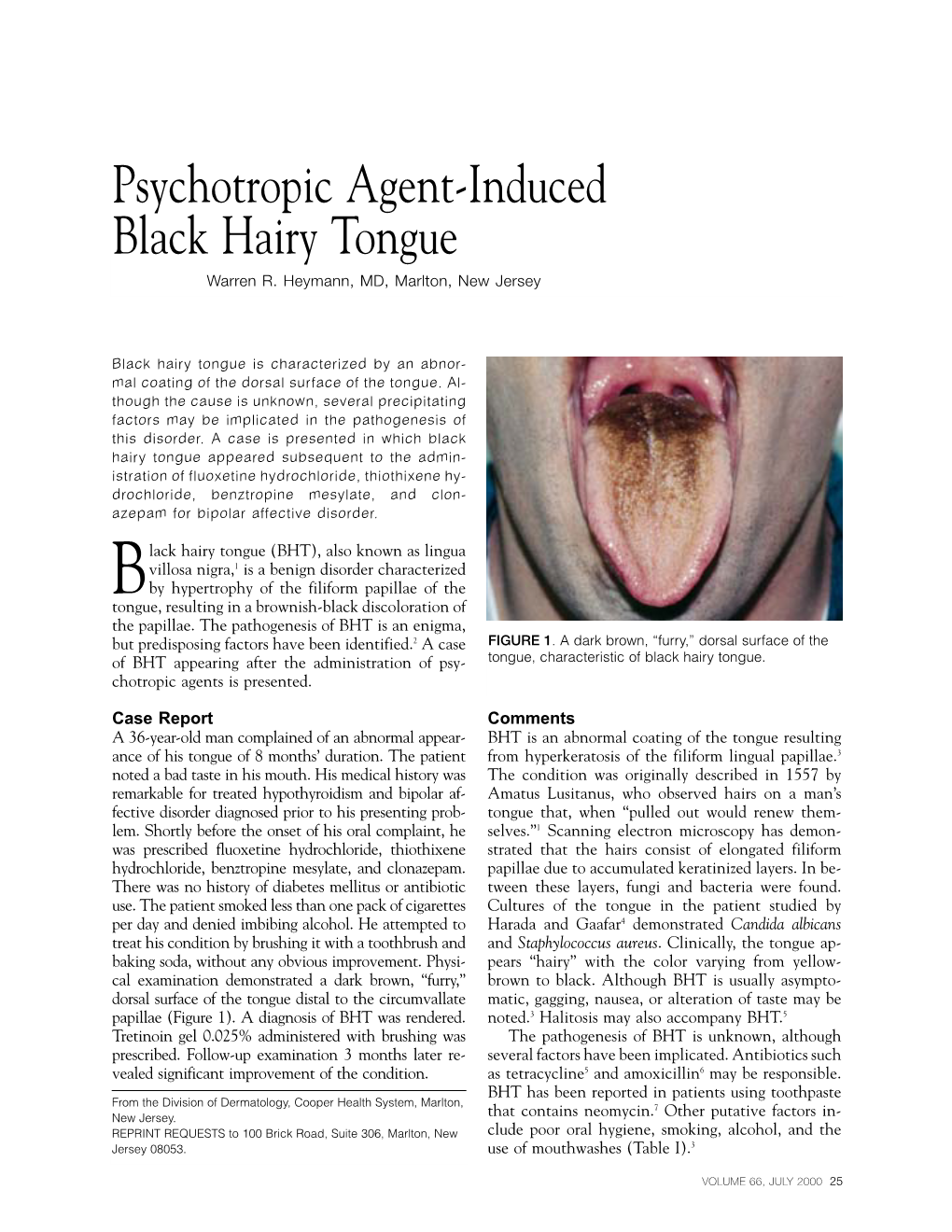 Psychotropic Agent-Induced Black Hairy Tongue Warren R