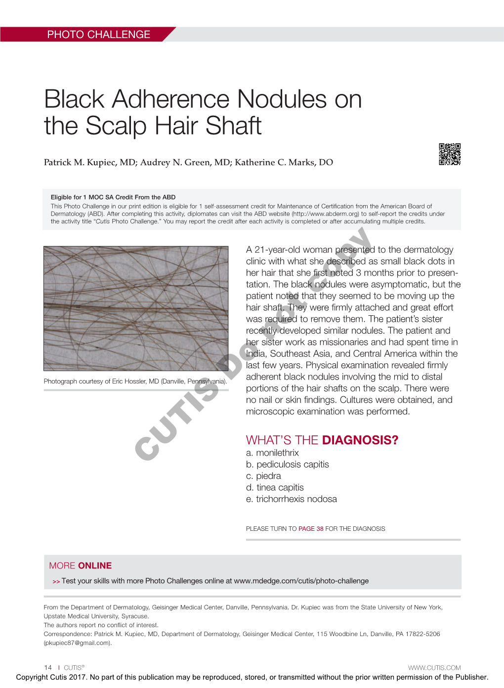 Black Adherence Nodules on the Scalp Hair Shaft