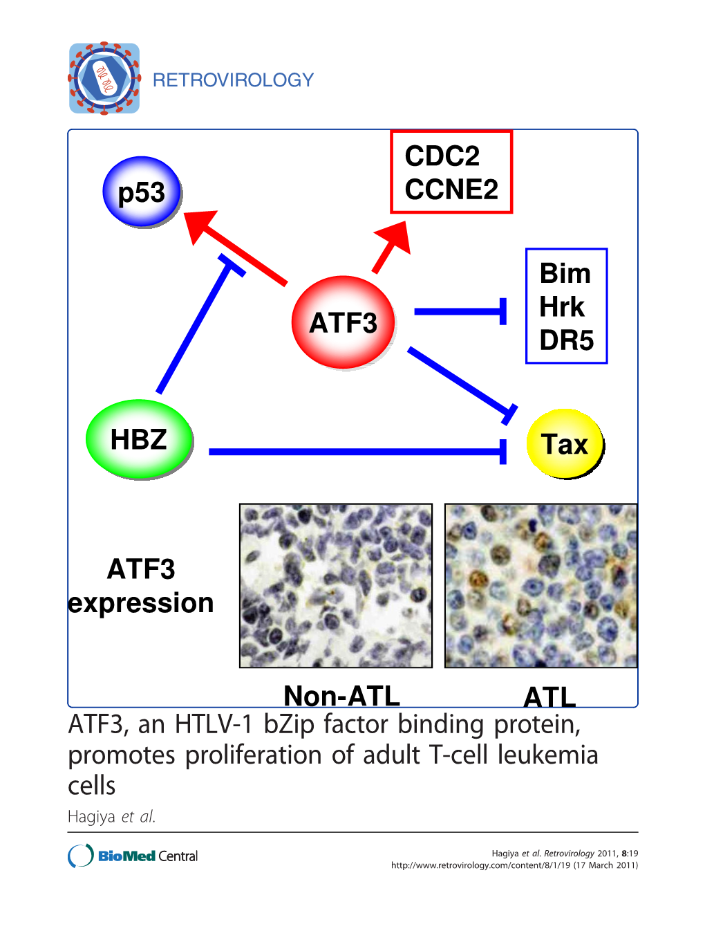 ATF3, an HTLV-1 Bzip Factor Binding Protein, Promotes Proliferation of Adult T-Cell Leukemia Cells Hagiya Et Al