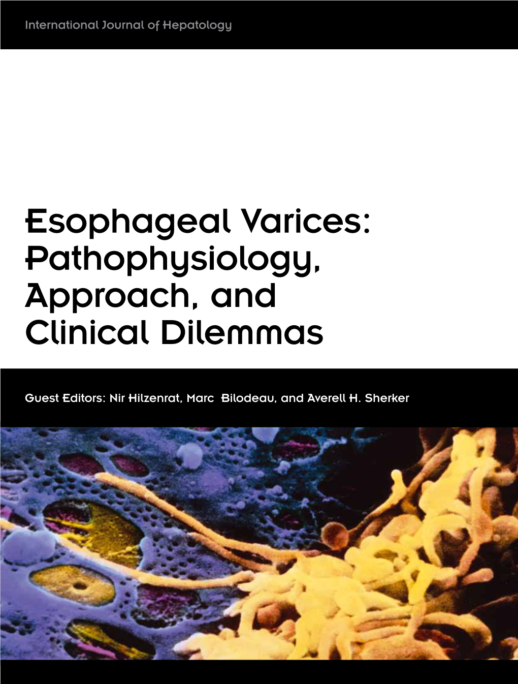 Esophageal Varices: Pathophysiology, Approach, and Clinical Dilemmas