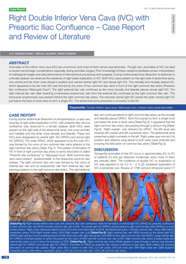 Right Double Inferior Vena Cava (IVC) with Preaortic Iliac Confluence – Case Report a Natomy Section and Review of Literature
