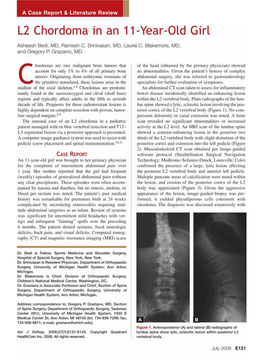 L2 Chordoma in an 11-Year-Old Girl