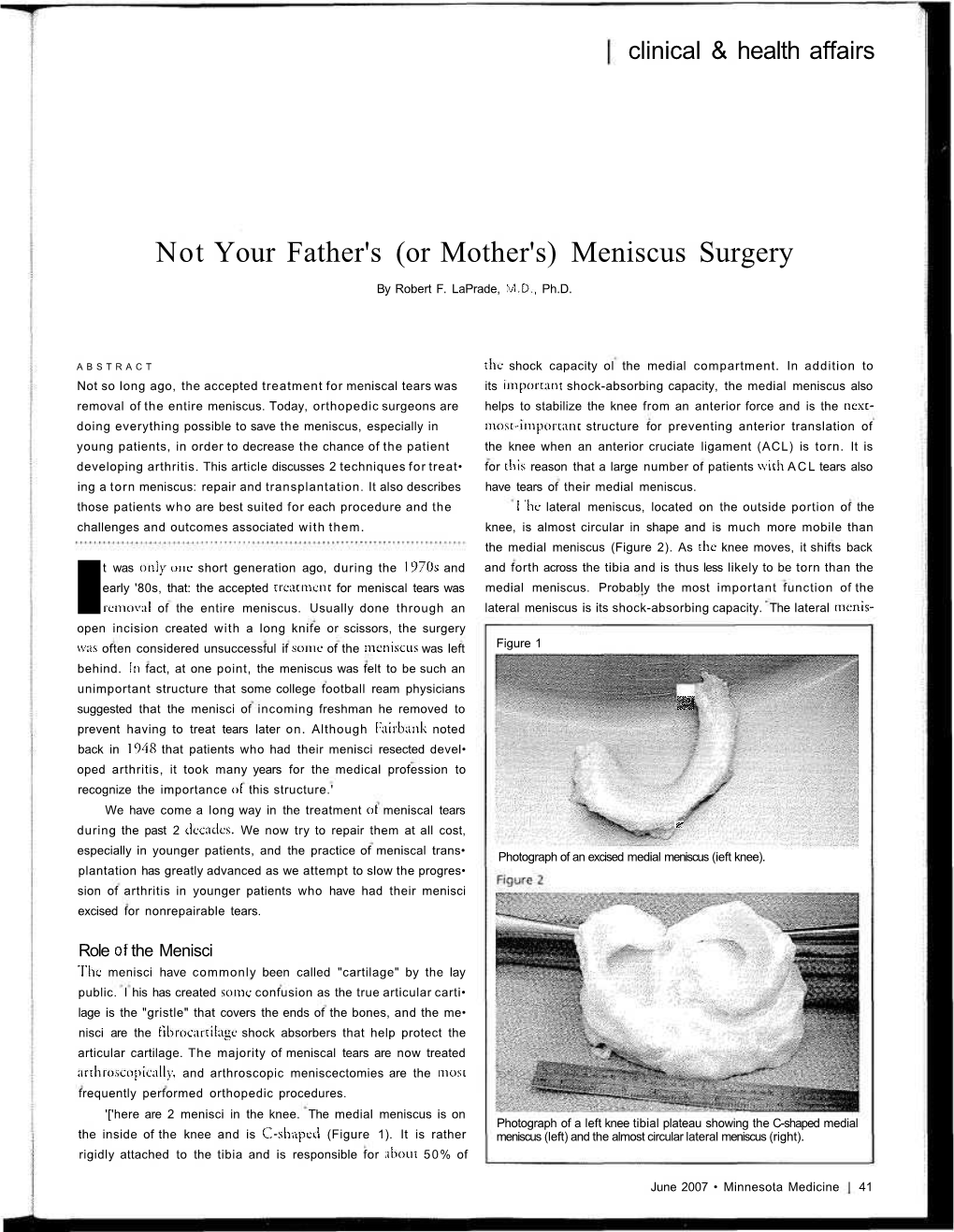Not Your Father's (Or Mother's) Meniscus Surgery
