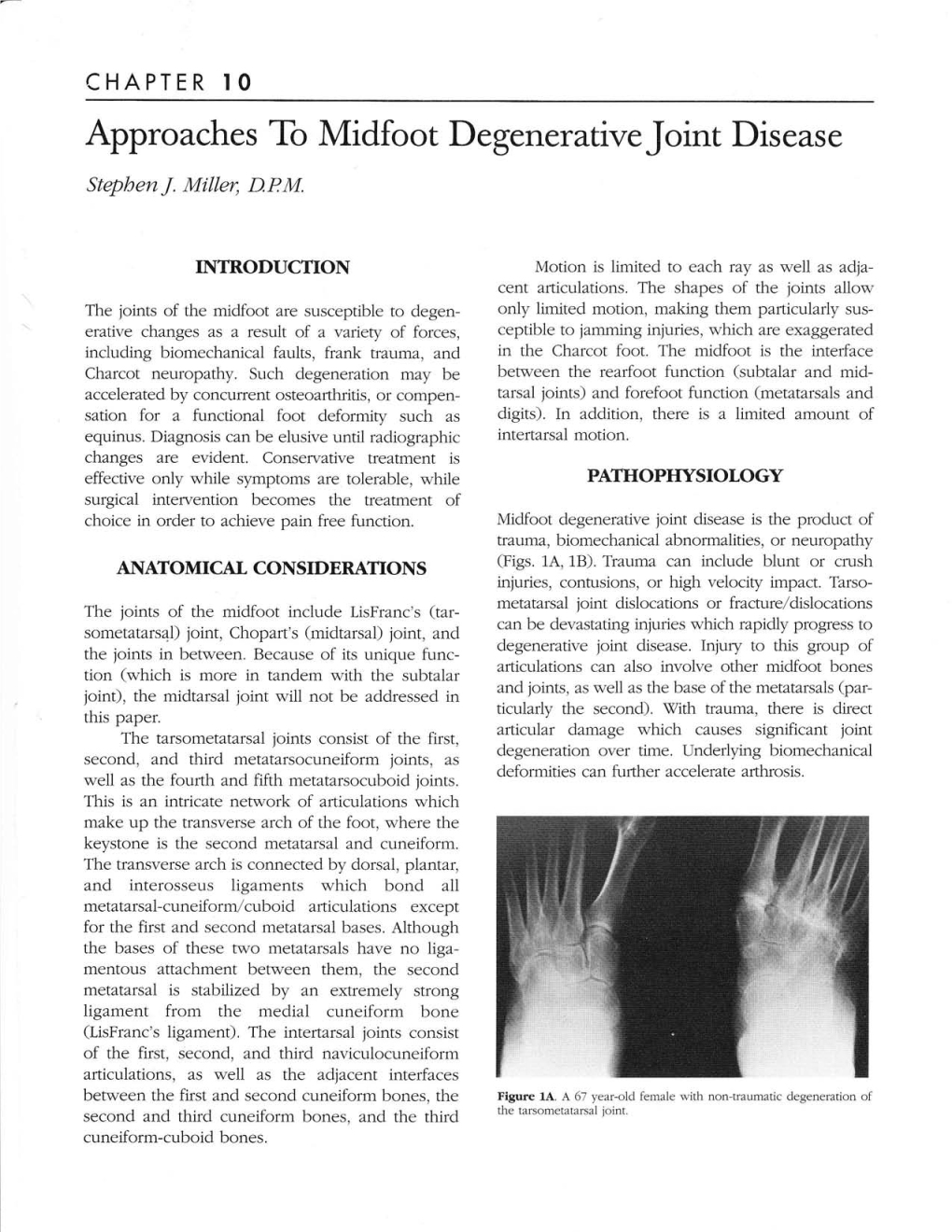 Approaches to Midfoot Degenerative Joint Disease Stepben J