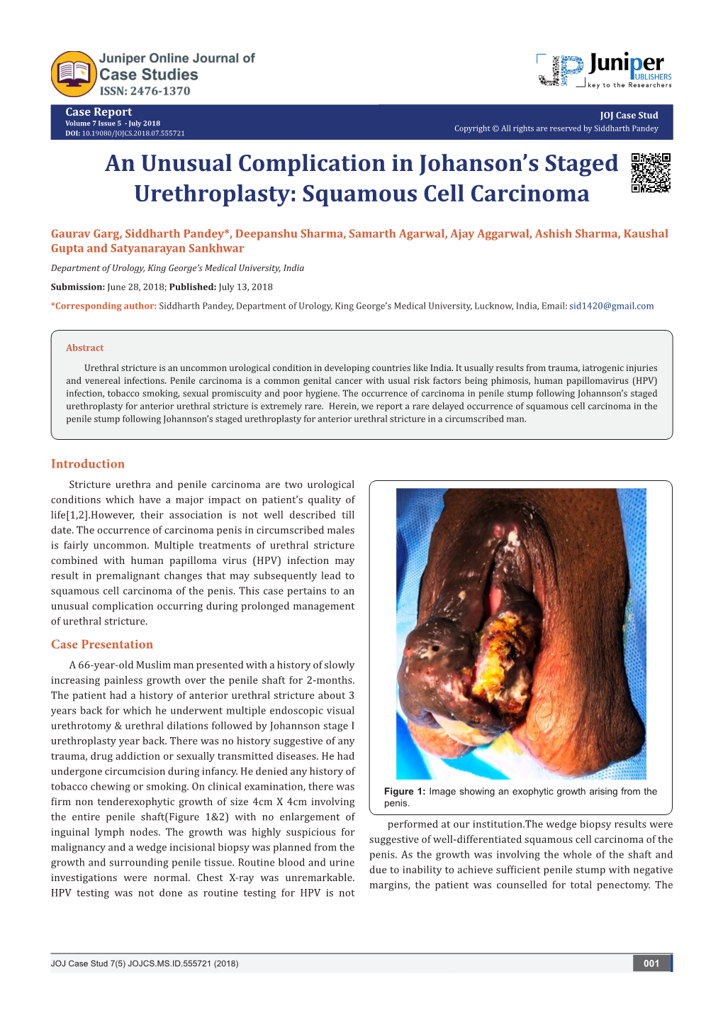 Squamous Cell Carcinoma