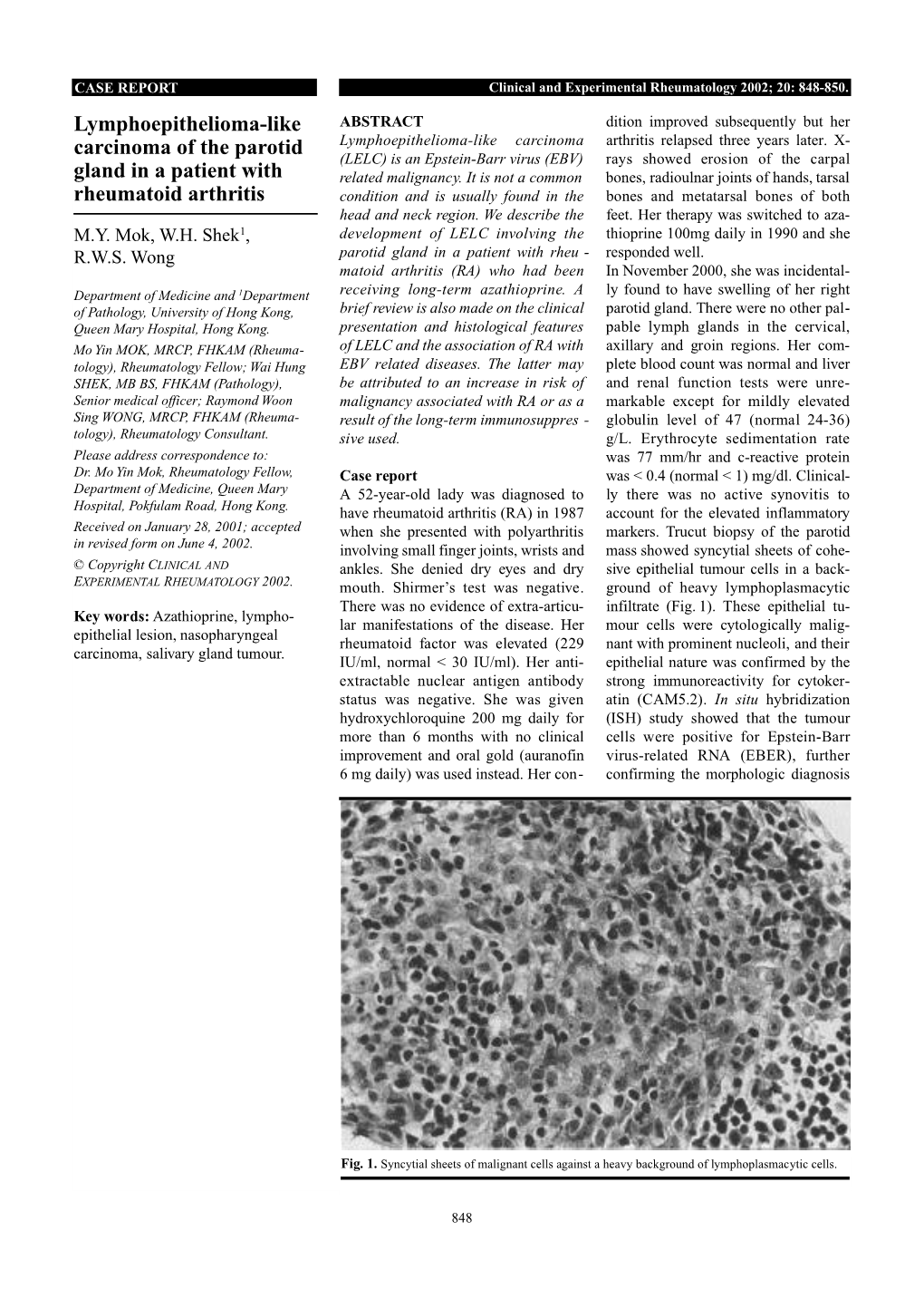 Lymphoepithelioma-Like Carcinoma of the Parotid Gland in a Patient With