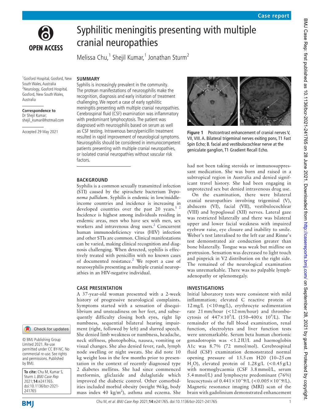 Syphilitic Meningitis Presenting with Multiple Cranial Neuropathies Melissa Chu,1 Shejil Kumar,1 Jonathan Sturm2