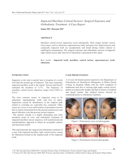 Impacted Maxillary Central Incisors: Surgical Exposure and Orthodontic Treatment: a Case Report Islam MS1, Hossain MZ2