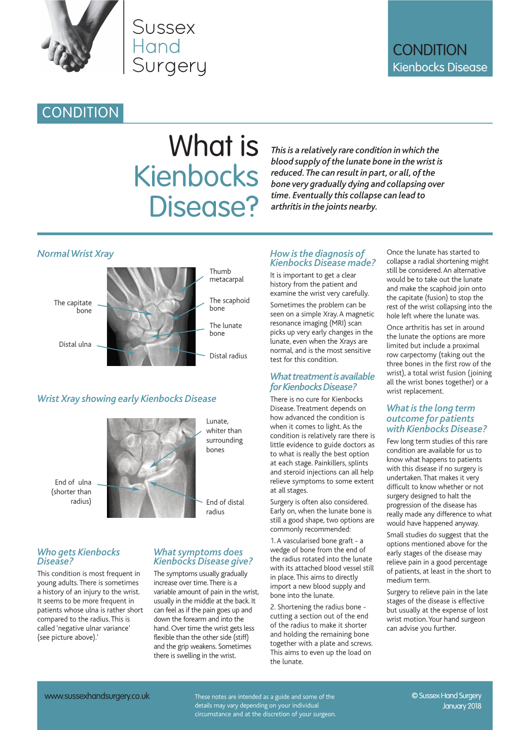 What Is Kienbocks Disease?