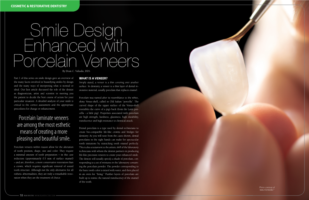 Smile Design Enhanced with Porcelain Veneers by Dean C