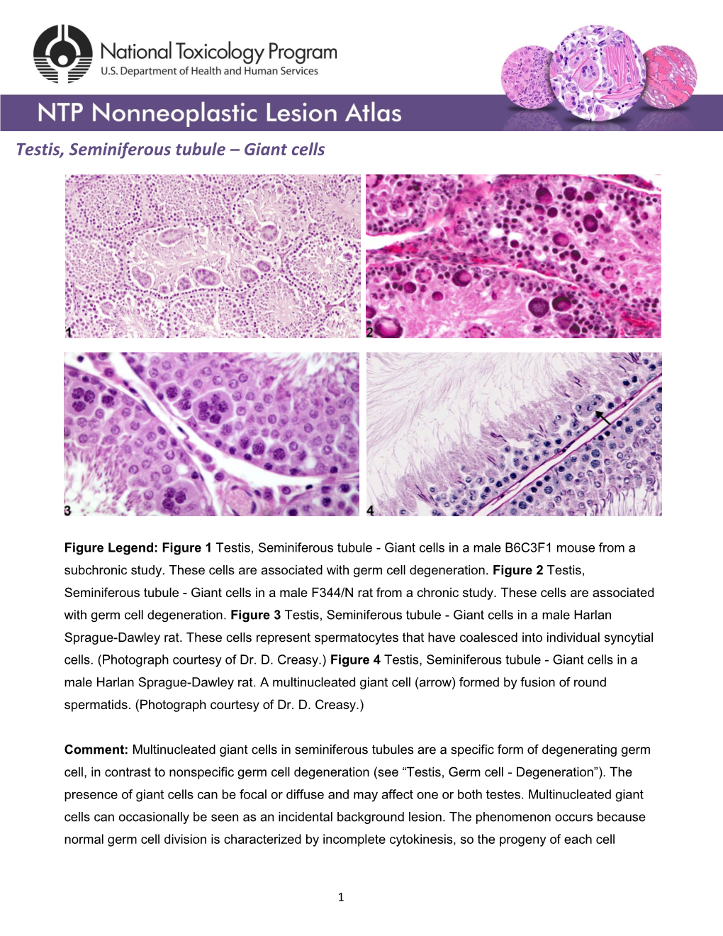 Testis, Seminiferous Tubule – Giant Cells