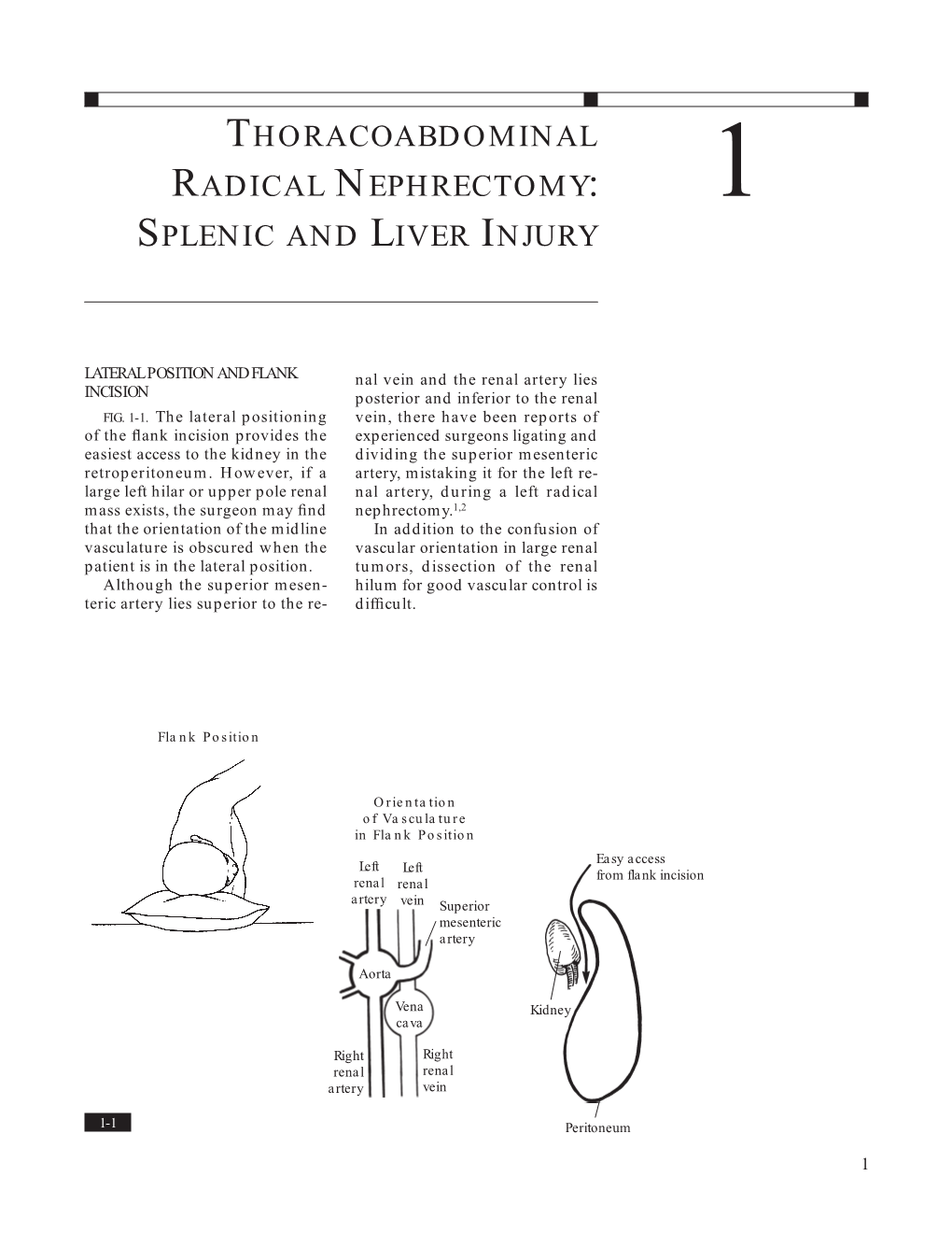 Thoracoabdominal Radical Nephrectomy: 1 Splenic and Liver Injury