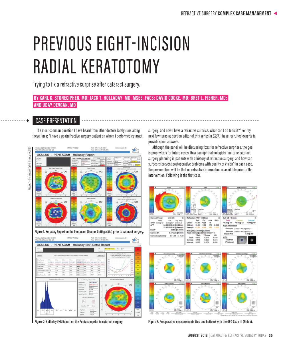 PREVIOUS EIGHT-INCISION RADIAL KERATOTOMY Trying to Fix a Refractive Surprise After Cataract Surgery