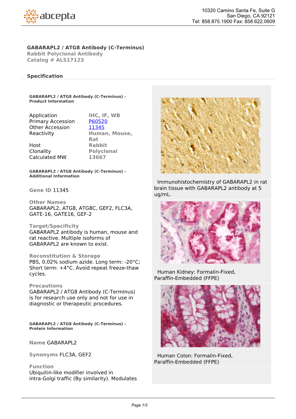 GABARAPL2 / ATG8 Antibody (C-Terminus) Rabbit Polyclonal Antibody Catalog # ALS17123